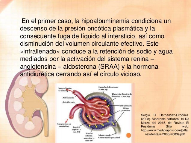 Sindrome Nefrotico Pdf